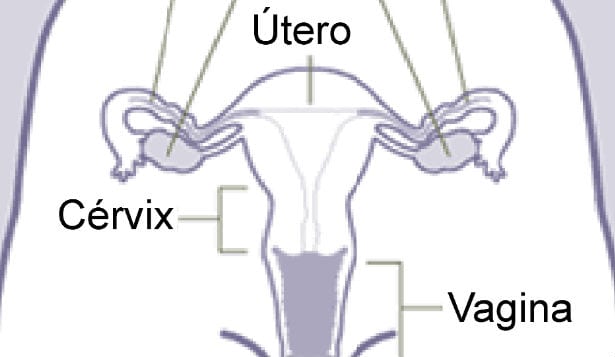 Candidiasis vaginal